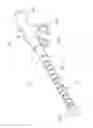 Fig. 02 - BONE DISTRACTION APPARATUS IN WHICH A FLEXIBLE DRIVE ASSEMBLY IS USED