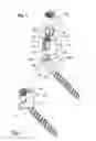 Fig. 02 - Polyaxial bone anchoring device with enlarged pivot angle