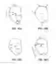Fig. 15 - Endodontic instruments with offset centers of mass