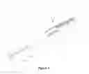 Fig. 02 - Dental oral shield device and system
