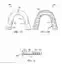 Fig. 02 - INTRA-ORAL VIBRATING OTHODONTIC DEVICES