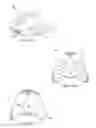 Fig. 06 - INTRA-ORAL VIBRATING OTHODONTIC DEVICES