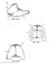 Fig. 07 - INTRA-ORAL VIBRATING OTHODONTIC DEVICES