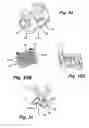 Fig. 35 - Self ligating orthodontic bracket having a rotatable member