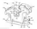 Fig. 01 - ORTHODONTIC APPLIANCE WITH LIGATING FEATURE
