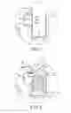 Fig. 05 - ORTHODONTIC APPLIANCE WITH LIGATING FEATURE
