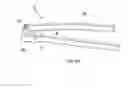 Fig. 07 - Bendable prosthesis post and angular adjustment method