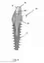 Fig. 06 - ABUTMENT ASSEMBLY FOR DENTAL IMPLANTS