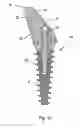 Fig. 07 - ABUTMENT ASSEMBLY FOR DENTAL IMPLANTS