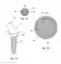 Fig. 09 - ABUTMENT ASSEMBLY FOR DENTAL IMPLANTS