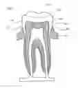 Fig. 09 - Method and system of making dental impressions