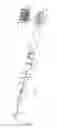 Fig. 06 - REPLACEABLE MULTI-DIRECTIONAL BRUSH HEAD FOR A TOOTHBRUSH AND A METHOD OF USING THE SAME