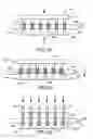Fig. 40 - Vaginal insert method of manufacture