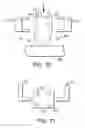 Fig. 46 - Vaginal insert method of manufacture