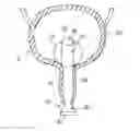 Fig. 01 - DEVICE AND METHOD FOR TREATING URINARY INCONTINENCE
