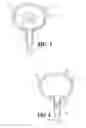 Fig. 02 - DEVICE AND METHOD FOR TREATING URINARY INCONTINENCE