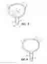 Fig. 03 - DEVICE AND METHOD FOR TREATING URINARY INCONTINENCE