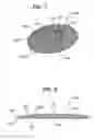 Fig. 07 - Temporary aids for deployment and fixation of tissue repair implants