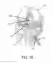 Fig. 07 - Apparatus and method for ligament reconstruction