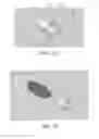 Fig. 41 - Apparatus and method for ligament reconstruction
