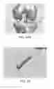 Fig. 46 - Apparatus and method for ligament reconstruction