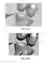 Fig. 53 - Apparatus and method for ligament reconstruction