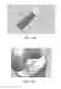 Fig. 77 - Apparatus and method for ligament reconstruction