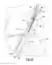Fig. 22 - Method and apparatus for fixation of an ACL graft