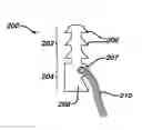 Fig. 01 - Methods for ligament reconstruction