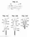 Fig. 11 - Methods for ligament reconstruction
