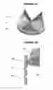 Fig. 02 - Method and apparatus for fine adjustment of a percutaneous valve structure