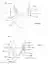 Fig. 04 - Transcatheter Mitral Valve Replacement Apparatus