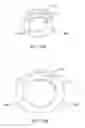 Fig. 30 - Transcatheter Mitral Valve Replacement Apparatus