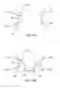 Fig. 32 - Transcatheter Mitral Valve Replacement Apparatus