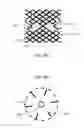 Fig. 41 - Transcatheter Mitral Valve Replacement Apparatus