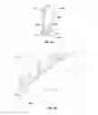 Fig. 03 - Leaflet-cuff attachments for prosthetic heart valve