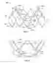 Fig. 04 - Leaflet-cuff attachments for prosthetic heart valve