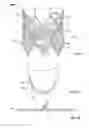 Fig. 06 - Leaflet-cuff attachments for prosthetic heart valve
