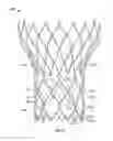 Fig. 07 - Leaflet-cuff attachments for prosthetic heart valve