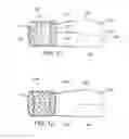 Fig. 08 - PROSTHETIC INSERT FOR TREATING A MITRAL VALVE