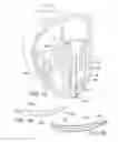 Fig. 09 - PROSTHETIC INSERT FOR TREATING A MITRAL VALVE