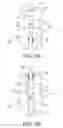 Fig. 04 - Bone implants for orthopedic procedures and corresponding methods