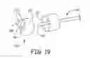Fig. 09 - Bone implants for orthopedic procedures and corresponding methods