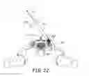 Fig. 11 - Bone implants for orthopedic procedures and corresponding methods