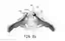 Fig. 15 - Bone implants for orthopedic procedures and corresponding methods
