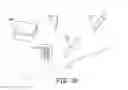 Fig. 18 - Bone implants for orthopedic procedures and corresponding methods