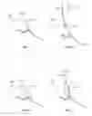 Fig. 03 - Orthopedic augment with cement trough containing projections