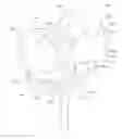 Fig. 01 - High performance knee prostheses