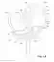 Fig. 02 - High performance knee prostheses