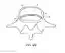 Fig. 07 - In-situ formed intervertebral fusion device and method